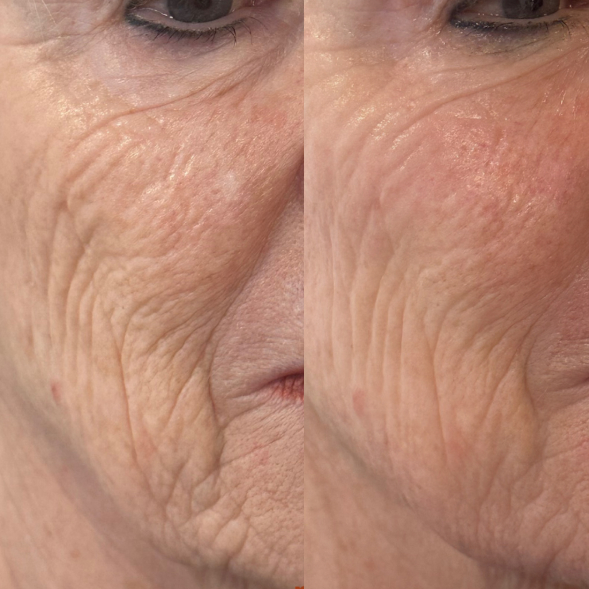 Before/after � male