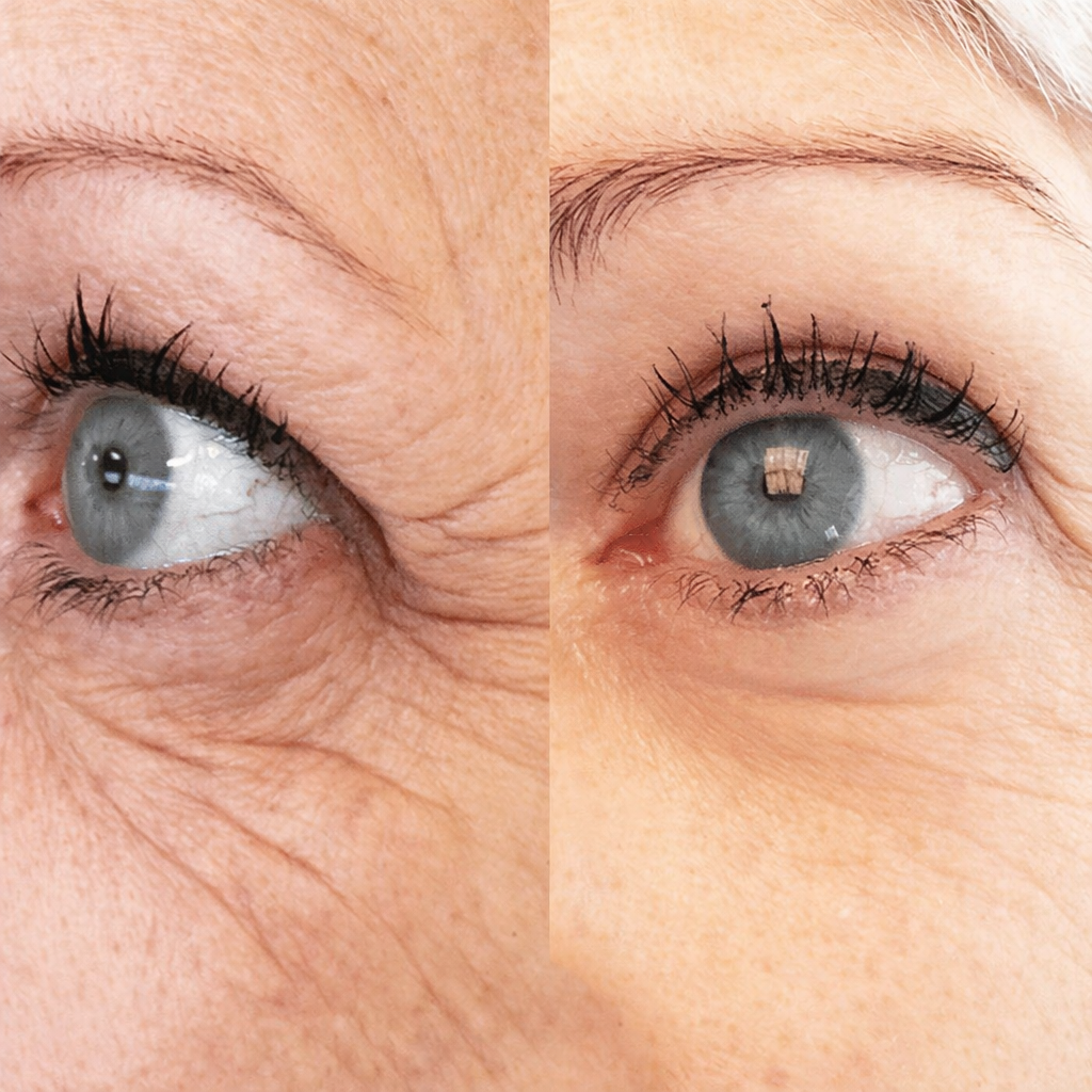 Before/after � male