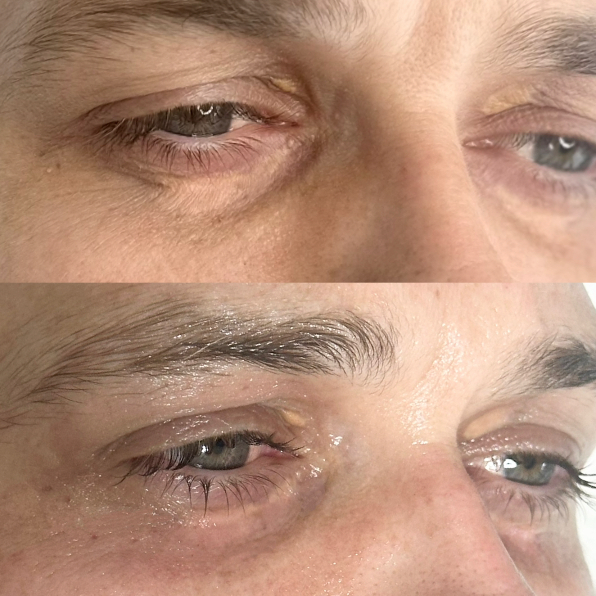MESO EXOCELL VOLUME+ � before/after