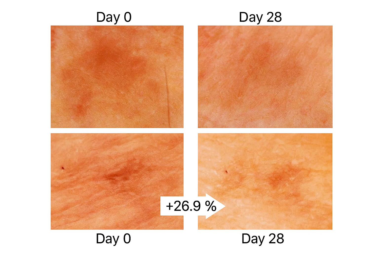 Study images: age spots before/after