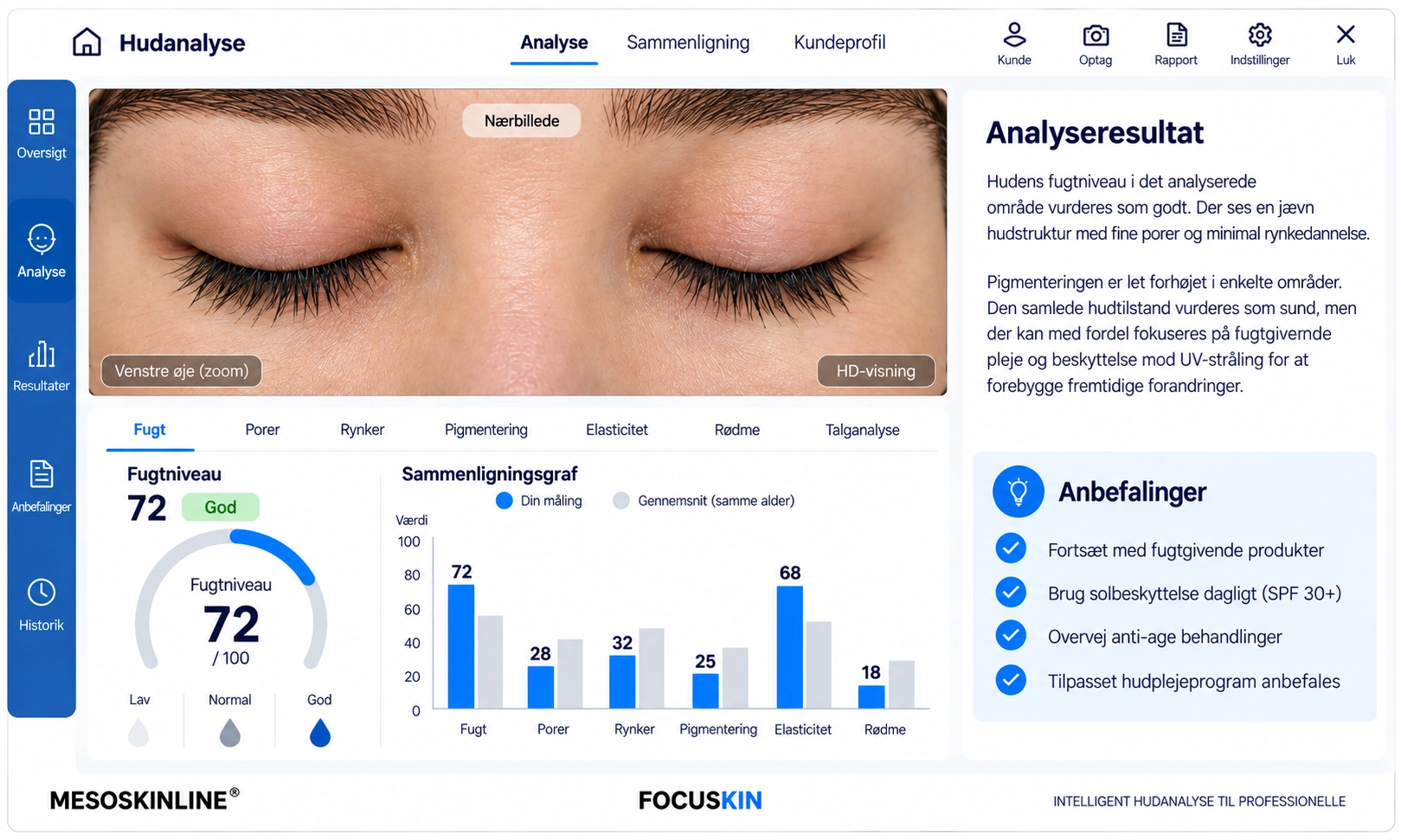 Focuskin detaljeret rynkeanalyse