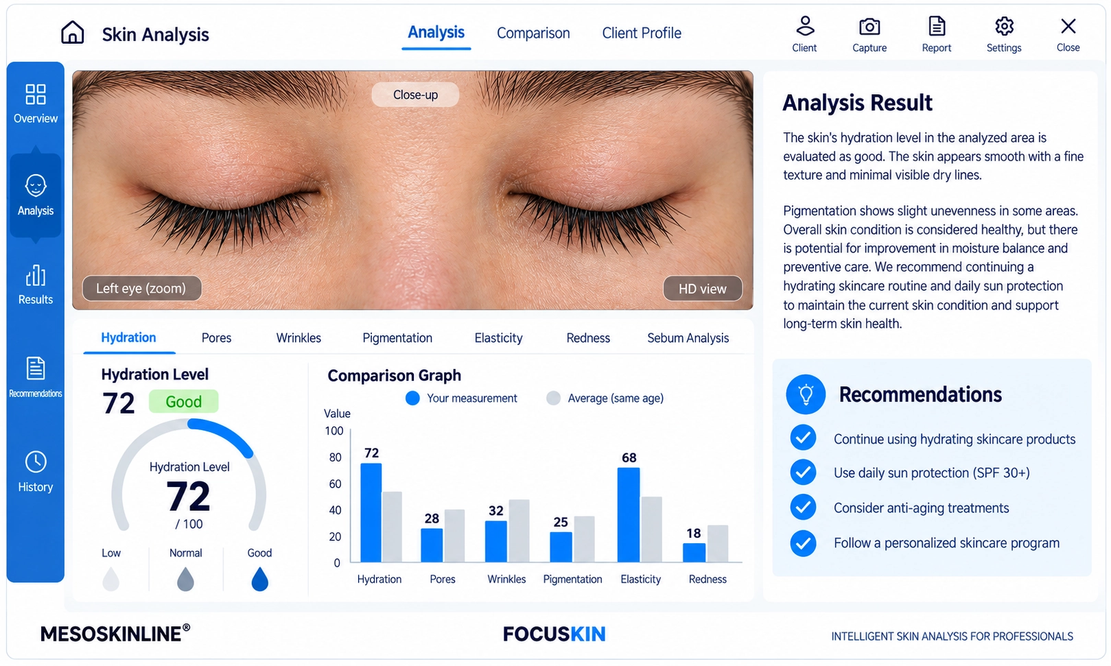Focuskin detaillierte Faltenanalyse