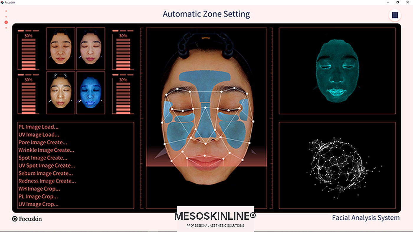 Focuskin automatische Einstellung der Analysebereiche