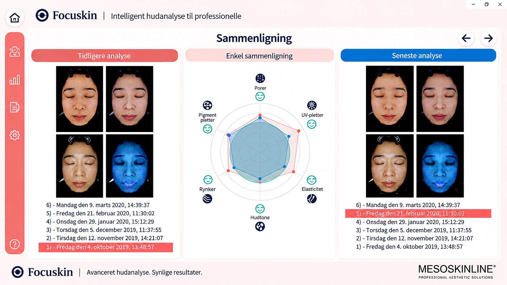 Focuskin sammenligningsanalyse