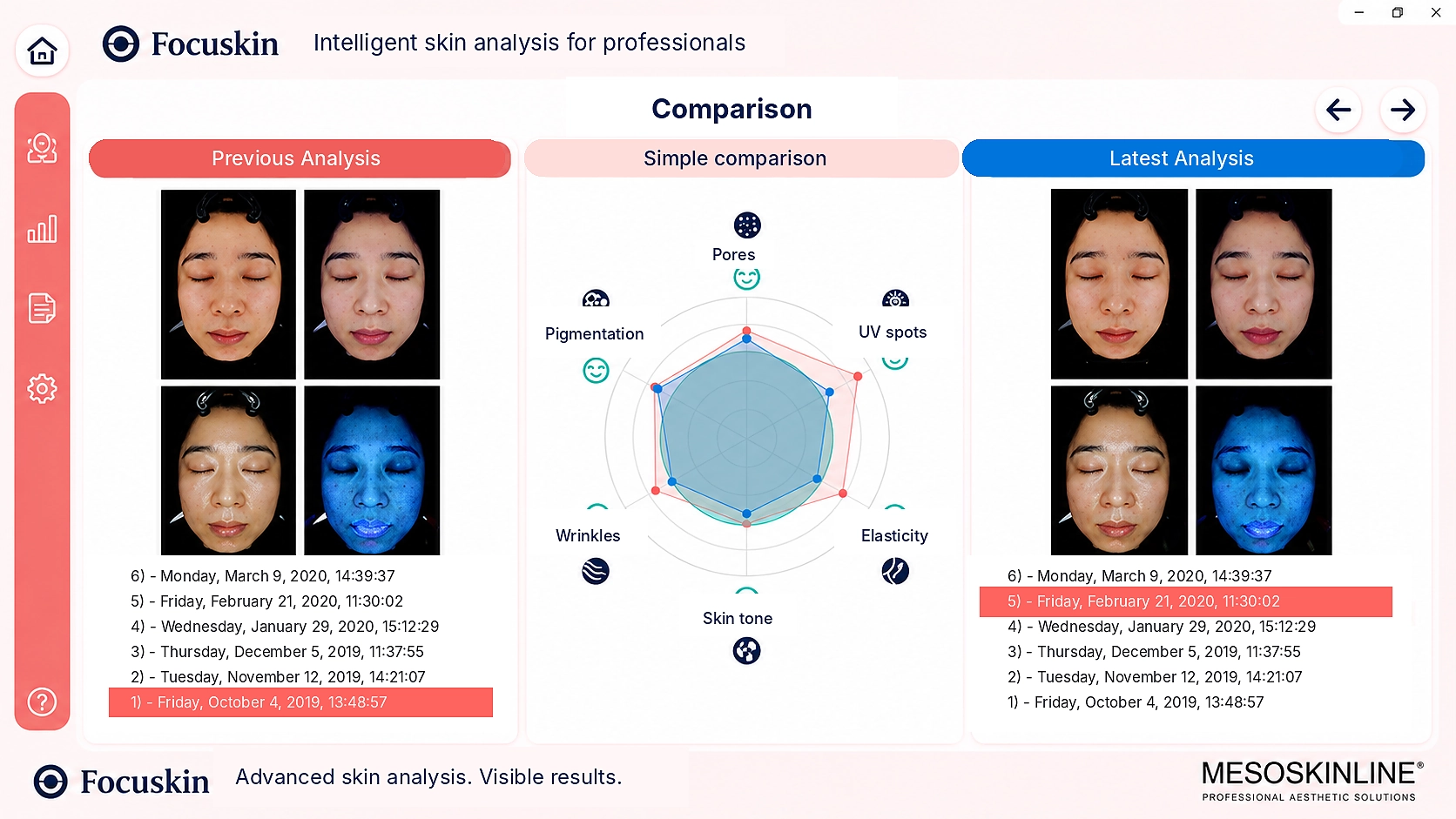 Focuskin Vergleichsanalyse