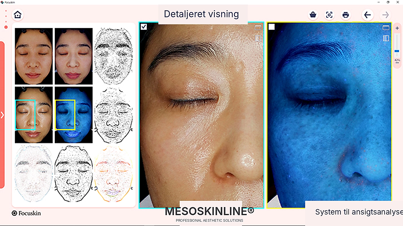 Focuskin detaljeret visning