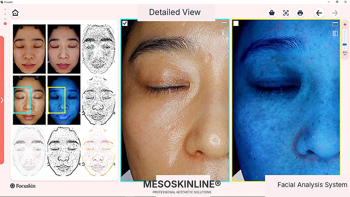 Focuskin Detailansicht