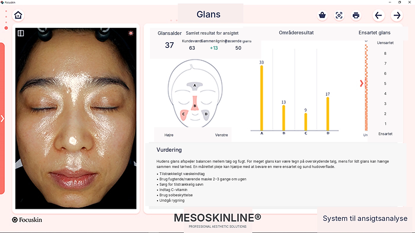 Focuskin analyse af hudens glans