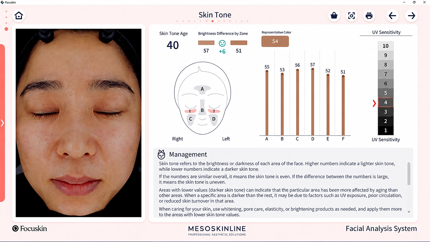 Focuskin analyse af hudtone