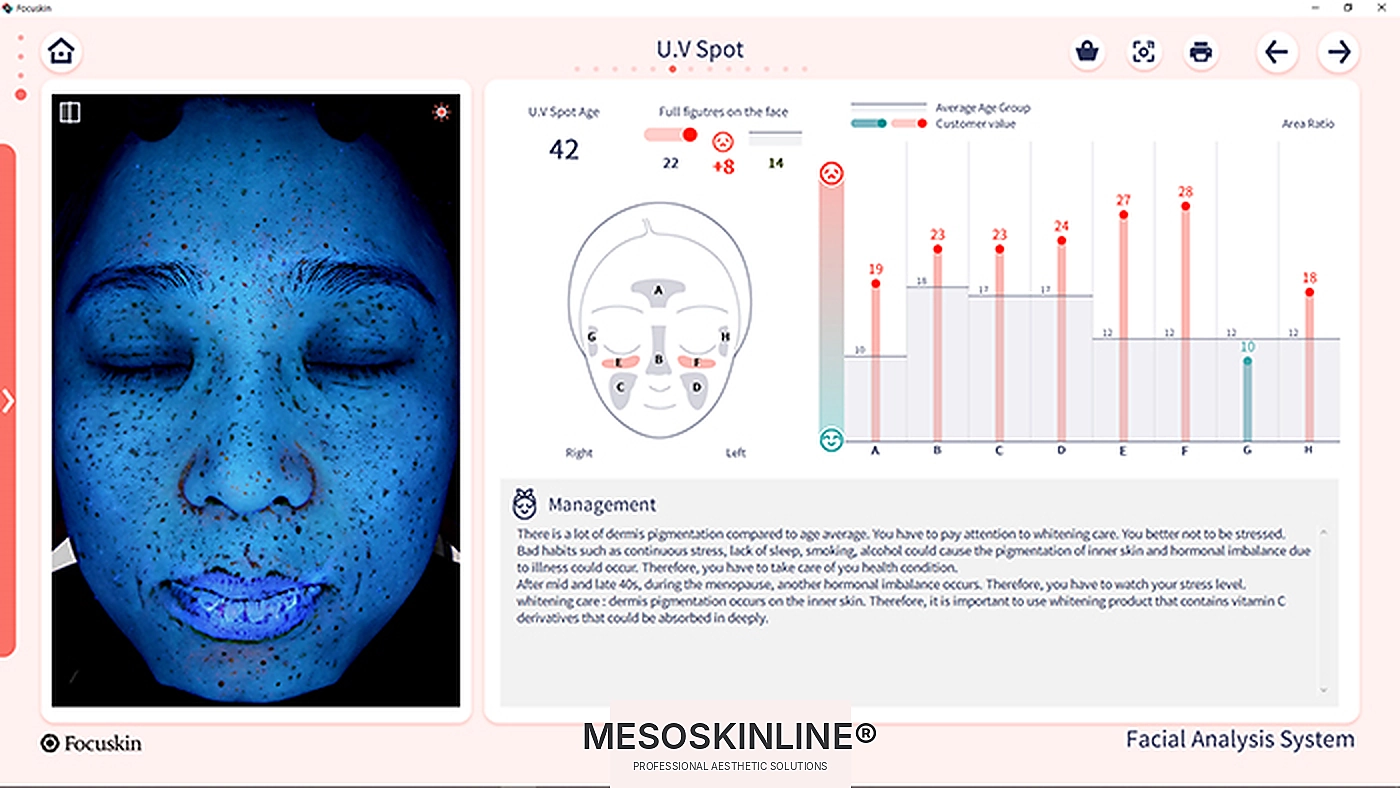 Focuskin Analyse der UV-Pigmentierung