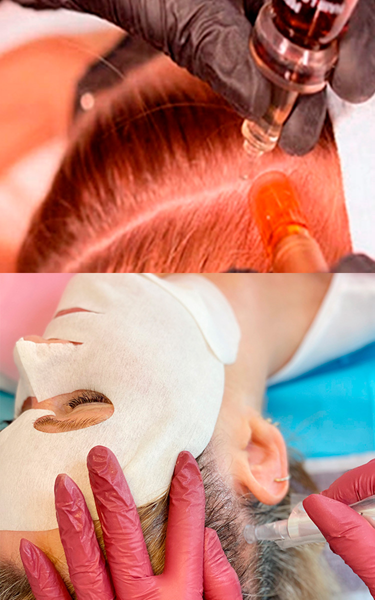 Clinical collage  hair growth