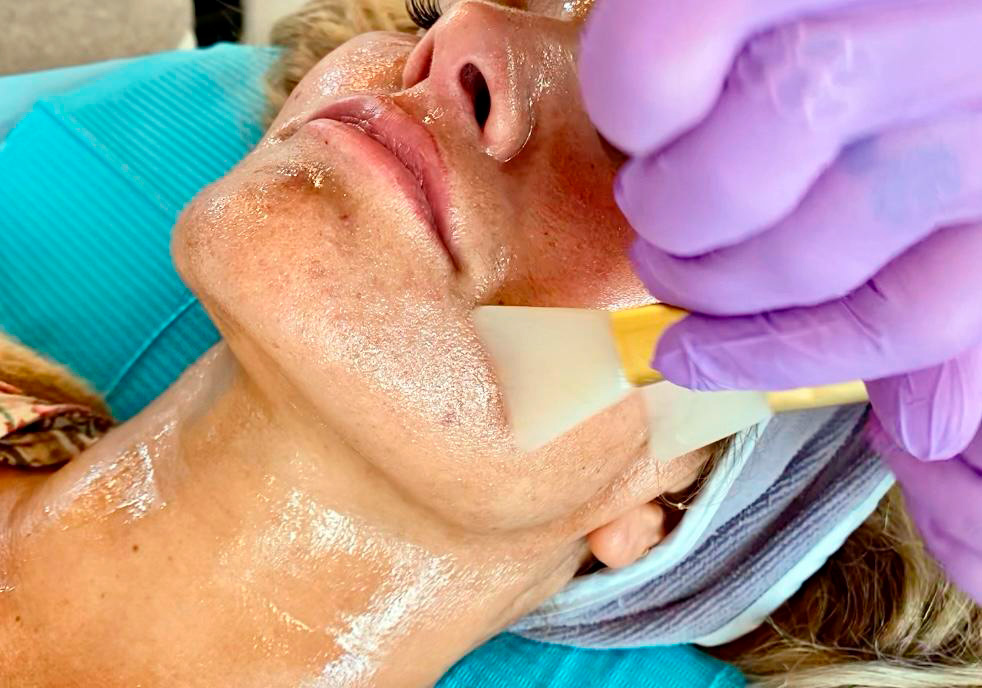 Klinischer Peeling‑Kurs