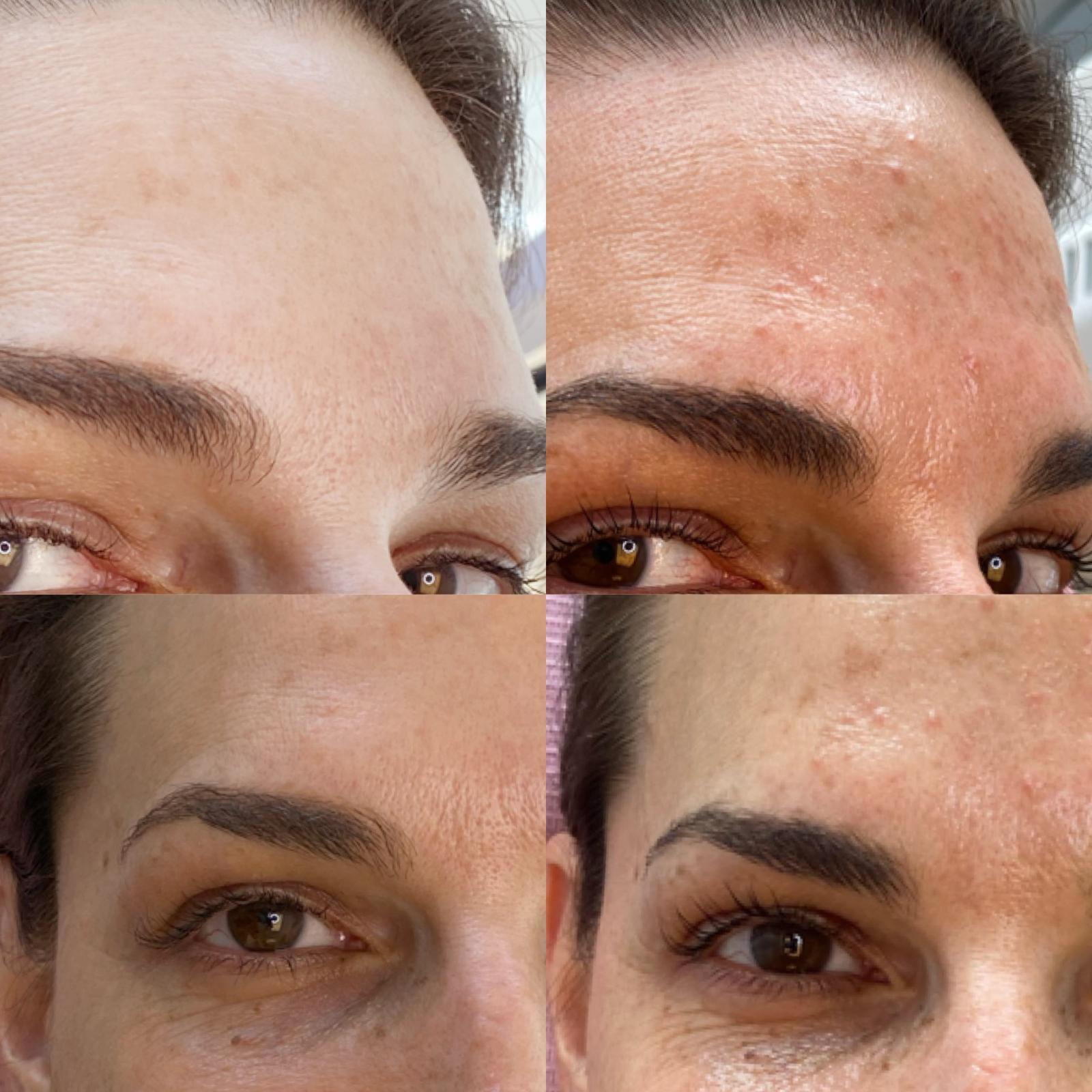 Peel  product