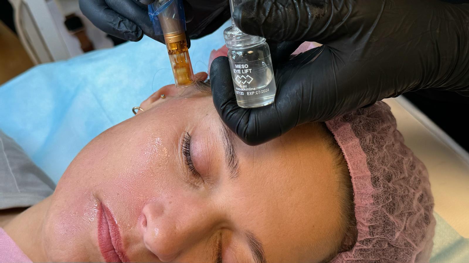 Professionelle behandlingsprotokoller fra Mesoskinline