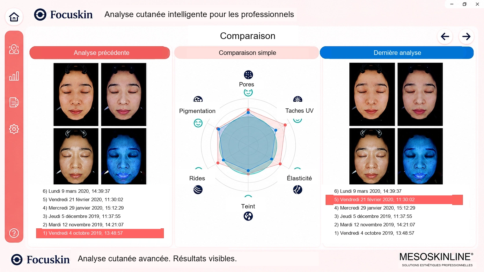 Analyse comparative Focuskin
