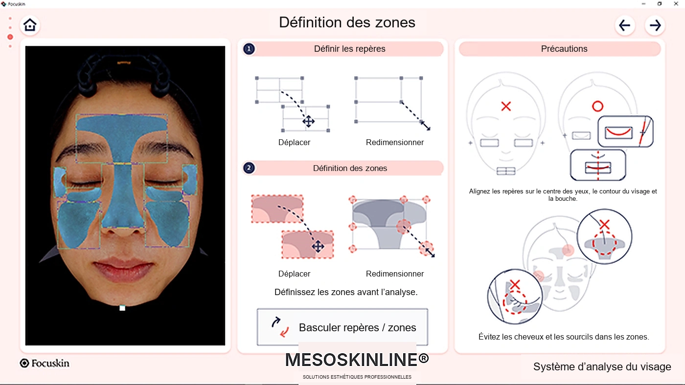Réglage manuel des zones d’analyse Focuskin