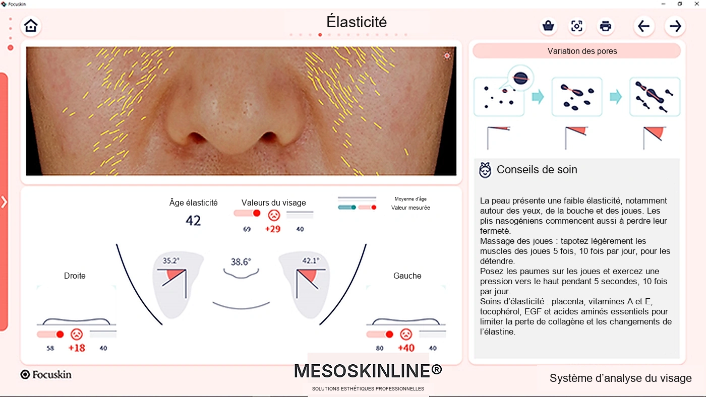Analyse de l’élasticité par imagerie avec Focuskin