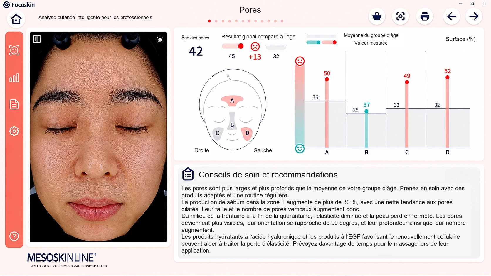 Analyse détaillée des pores avec Focuskin