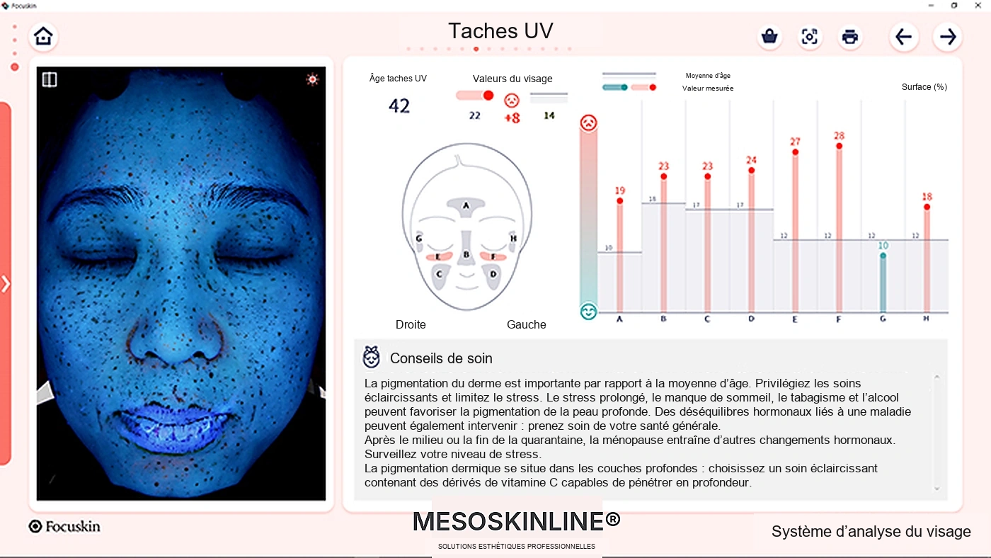 Analyse Focuskin de la pigmentation sous UV