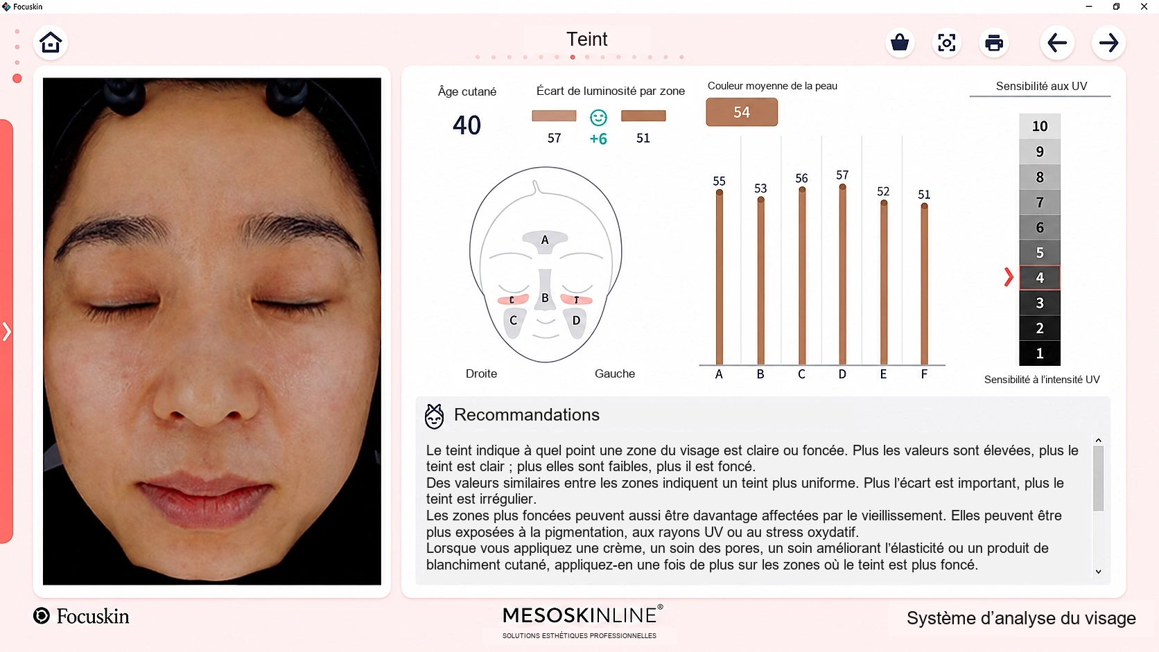 Analyse du teint avec Focuskin