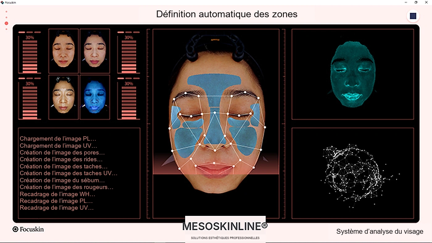 Réglage automatique des zones d’analyse Focuskin