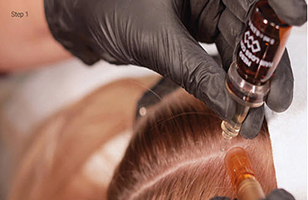 BEHANDLINGS PROCEDURER OG TEKNIKKER (NON INVASIVE)