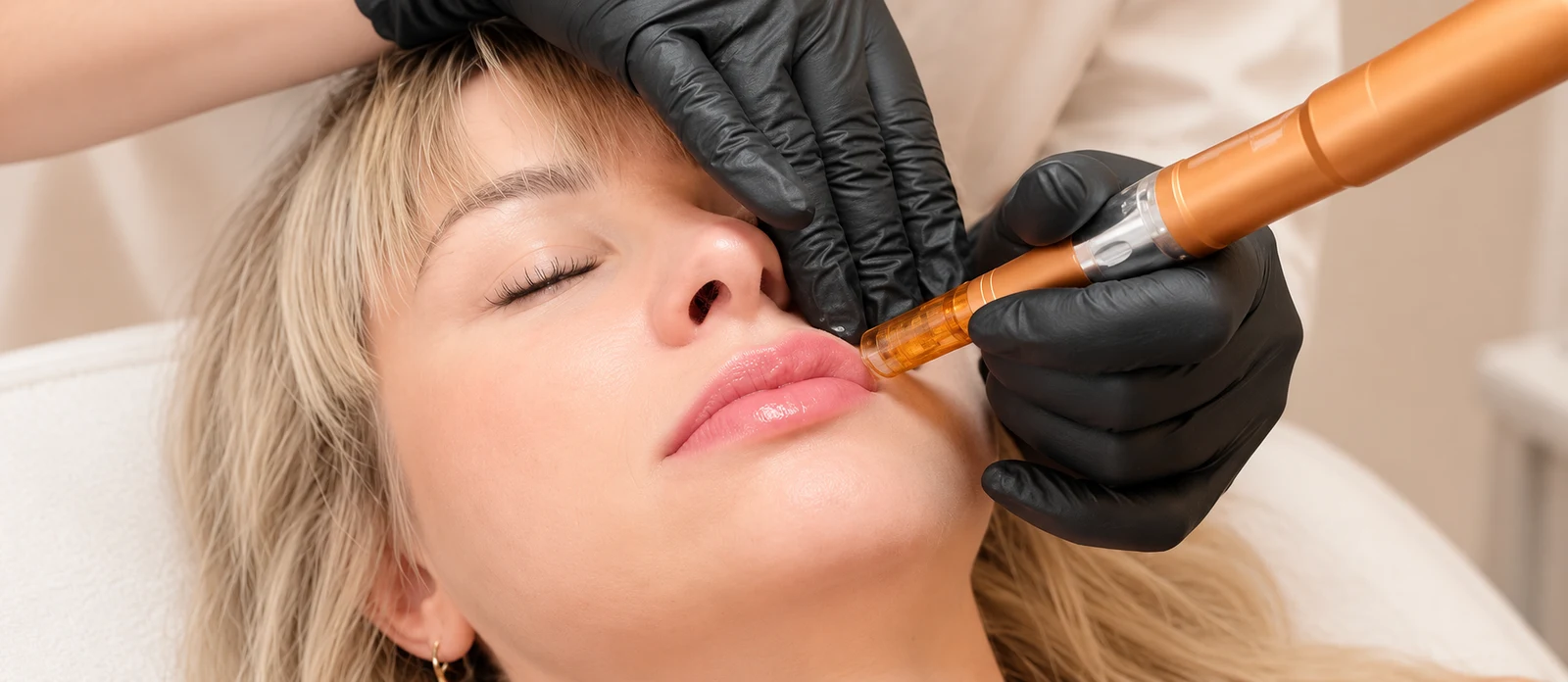 Meso LipVolume