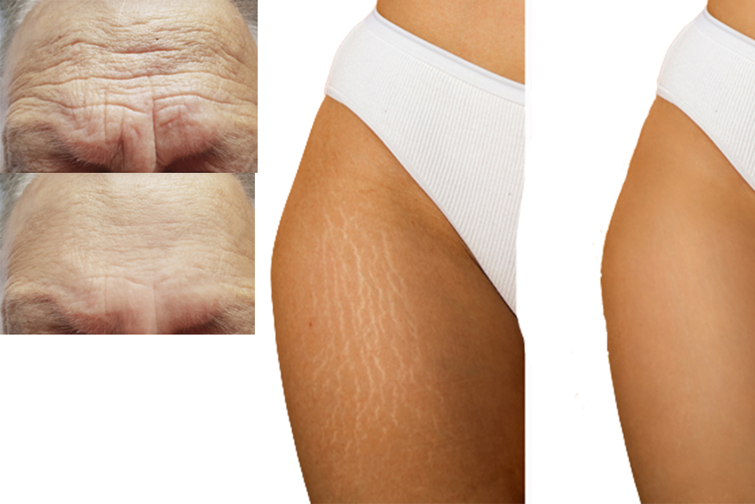 Copy of Copy of Mesotherapy Face Products