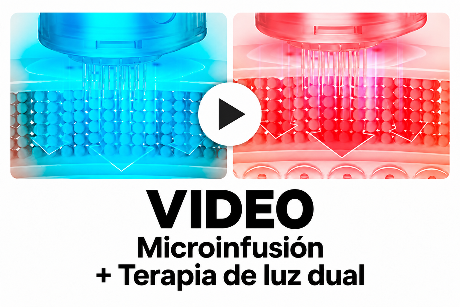 Microinfusi&oacute;n y luz dual con MESOpower MS7000