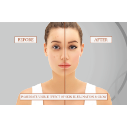 MESO SKIN PERFECTOR (LIGHT 5 x 6 ml)