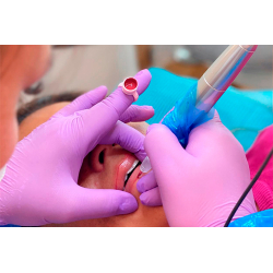 3D Lips Masterclass (Kombinierte Online-Lehre und Praktikum)