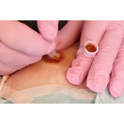 &#1050;&#1091;&#1088;&#1089; &#1087;&#1086; &#1082;&#1086;&#1088;&#1088;&#1077;&#1082;&#1094;&#1080;&#1080; &#1096;&#1088;&#1072;&#1084;&#1086;&#1074; &#1080; &#1072;&#1088;&#1077;&#1086;&#1083;