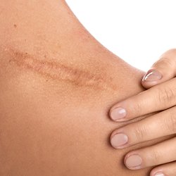 Kursus i arkorrektion og 3D areola (Kombineret online undervisning og praktik)