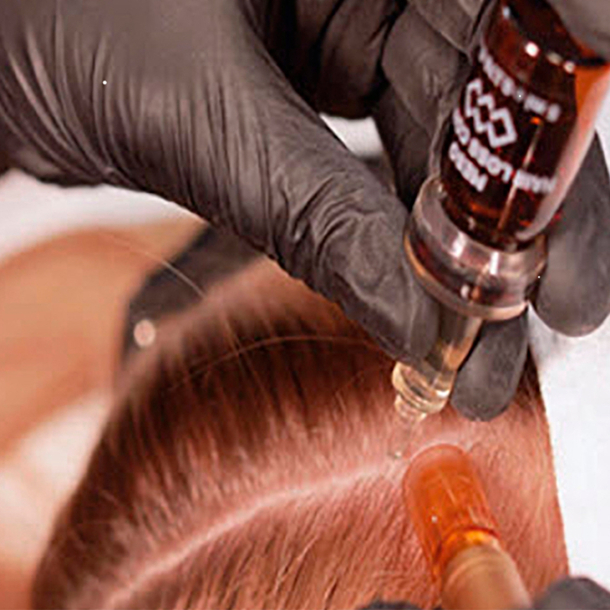 CPD Hair Growth &amp; Loss Prevention Course (Online &amp; Practical)