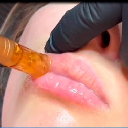 MESO LIPVOLUME &#1052;&#1072;&#1089;&#1090;&#1077;&#1088;-&#1082;&#1091;&#1088;&#1089; (&#1054;&#1053;&#1051;&#1040;&#1049;&#1053; &#1058;&#1045;&#1054;&#1056;&#1048;&#1071;, &#1055;&#1056;&#1040;&#1050;&#1058;&#1048;&#1063;&#1045;&#1057;&#1050;&#1054;&#1045; &#1054;&#1041;&#1059;&#1063;&#1045;&#1053;&#1048;&#1045; &#1042; &#1050;&#1059;&#1056;&#1057;&#1054;&#1042;&#1054;&#1052; &#1062;&#1045;&#1053;&#1058;&#1056;&#1045;)