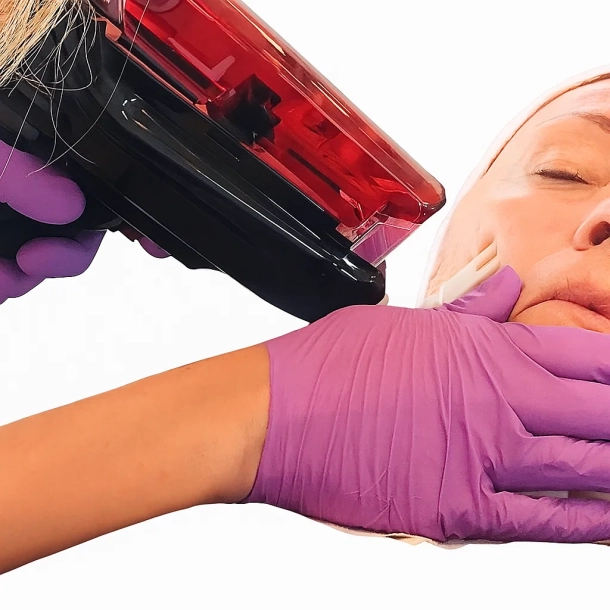 CPD Certified Invasive Mesotherapy Course (Online course)