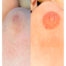 &#1052;&#1072;&#1089;&#1090;&#1077;&#1088;-&#1082;&#1083;&#1072;&#1089;&#1089; &#1087;&#1086; &#1084;&#1077;&#1076;&#1080;&#1094;&#1080;&#1085;&#1089;&#1082;&#1086;&#1081; &#1087;&#1080;&#1075;&#1084;&#1077;&#1085;&#1090;&#1072;&#1094;&#1080;&#1080; 