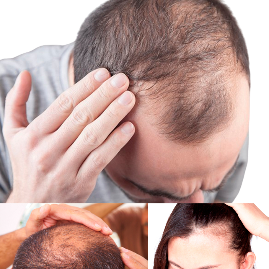 MESO HAIR GROWTH CONCEPT+ (Produktpakke)