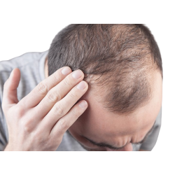 MESO HAIR GROWTH CONCEPT+ (Product package)