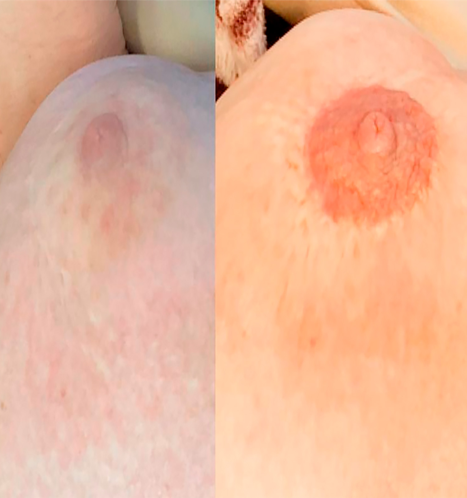Medicinsk pigmentering