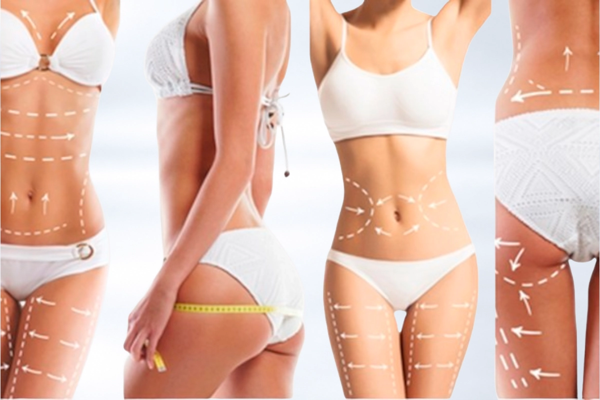 CUERPO