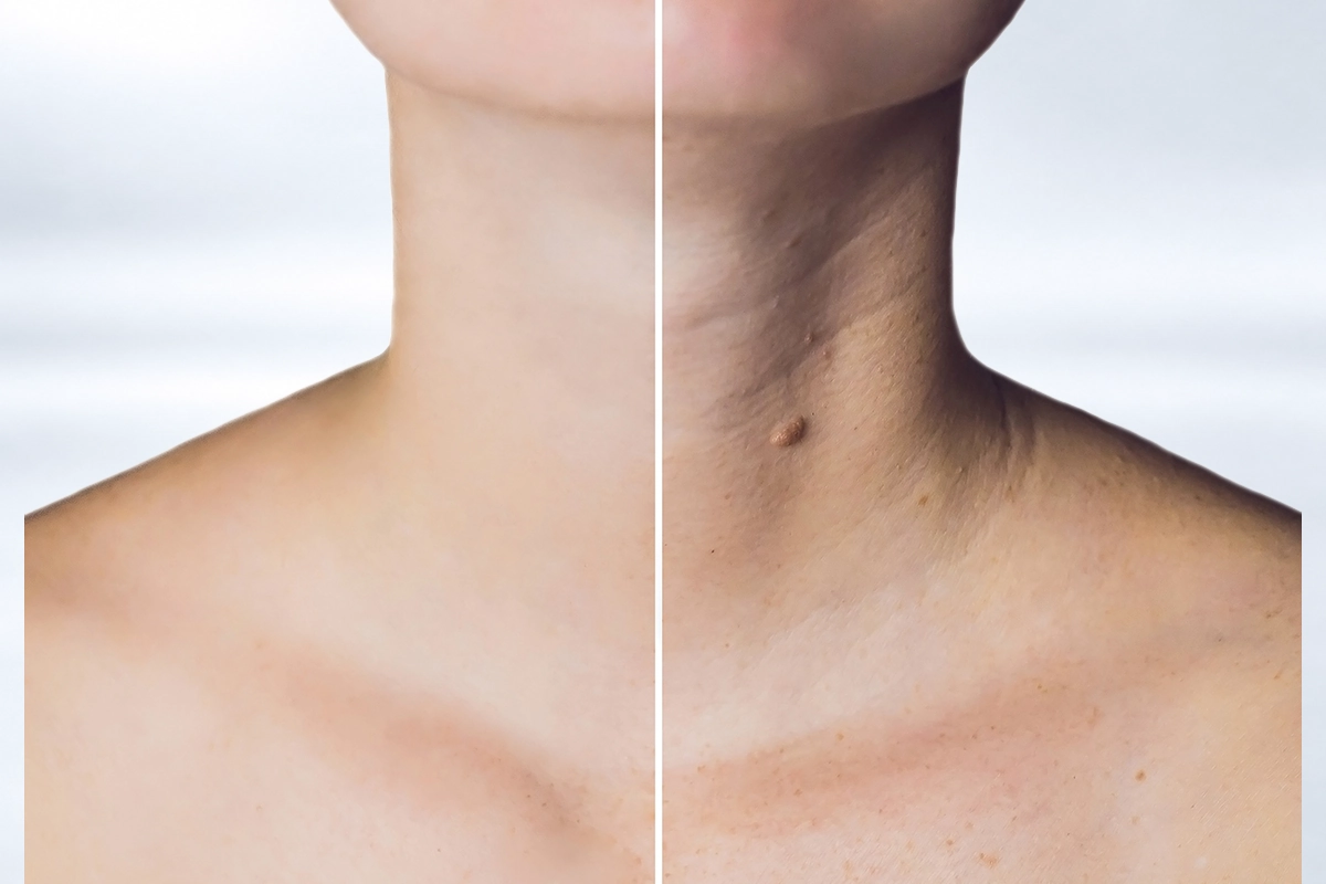 ESCOTE Y CUELLO