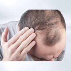 MESO HAIR GROWTH CONCEPT+ (Produktpakke)
