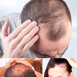 MESO HAIR GROWTH CONCEPT+ (Product package)